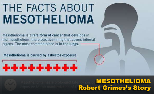 Mesothelioma – Robert Grimes’s Story